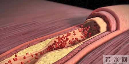 医生提醒：高血压患者长期吸烟酗酒，不到3年心脑血管或遭遇9损伤