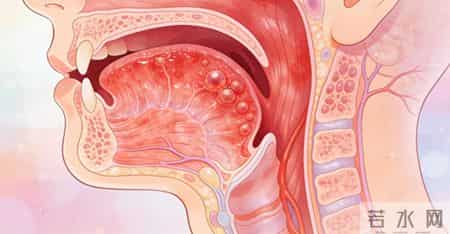 慢性咽炎不治会变严重吗？这些症状要重视，早诊断早治疗