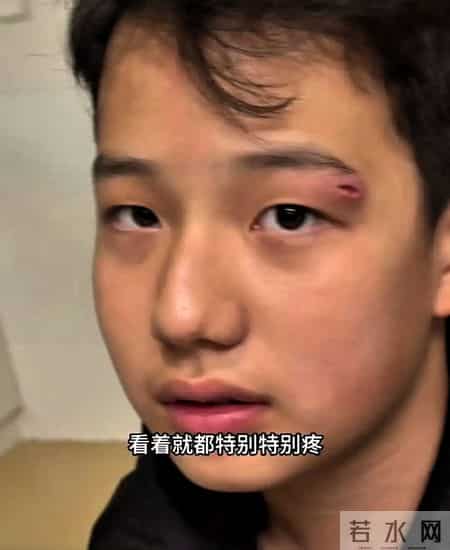 关凌深夜致歉儿子：一失手缝四针的愧疚，藏着天下父母育儿必修课