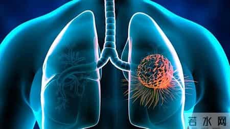 多名医生忠告：慢阻肺患者做过肺功能检测，务必重点4项核心结果