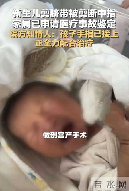 剪脐带剪到手指 这娃到底有多乱动