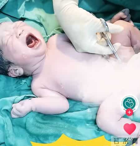 心疼到哭！新生儿剪脐带被剪断手指，医院的回应我听不下去