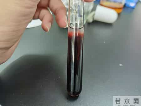 加快脑梗恶化的原因：不戴帽子仅第5，排第1的，很多人没发觉