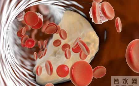 调查发现：活得久的高血脂患者，大多在确诊后，改掉了这些恶习
