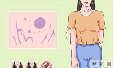 一听到“血液病”就慌？别怕这4种常见类型，管好了和正常人一样