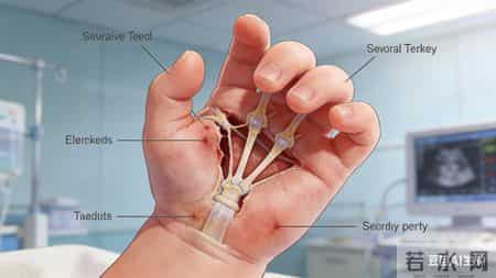 从专业角度，这是一个极其罕见且严重的医疗安全事件