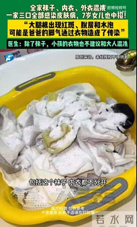 7岁女儿衣服与爸爸袜子混洗感染脚气 身上长红斑水泡