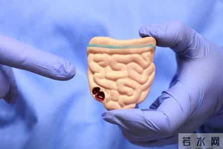 为什么肠癌患者越来越多？医生：烟酒影响很小，主要是5事做多了