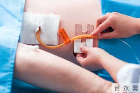 肠癌有多痛苦？为什么说肠道癌是最痛苦的疾病？一文详解！