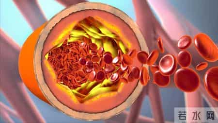 男子因脑梗不幸死亡！提醒：天冷宁愿在家打牌，也别干这些事！