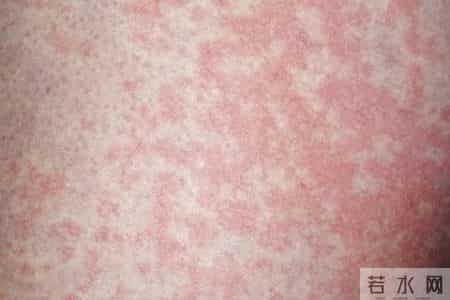 内衣袜子混洗，男子确诊感染！医生：这三件事要特别注意