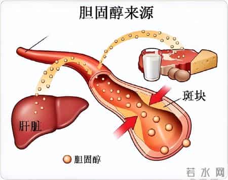 间隔一天吃他汀，降脂效果更好？医生建议：服用他汀，谨记这3点