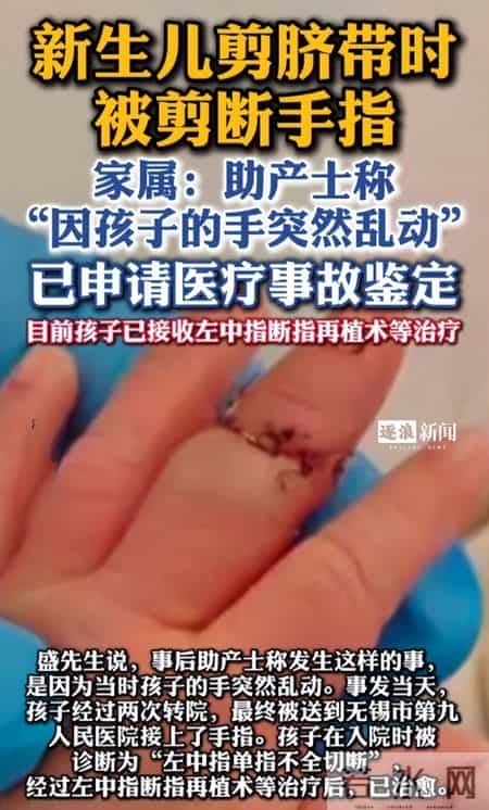 疼死了！新生儿被剪断手指紧急转院，暂不谈赔偿，家属发声太揪心