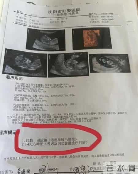 怀个孕跟开盲盒似的 一胎变四胎 还有个“小吸血鬼”