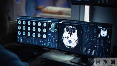 多名医生提醒：只要做过前列腺B超，中老年男性务必重视这5指标！