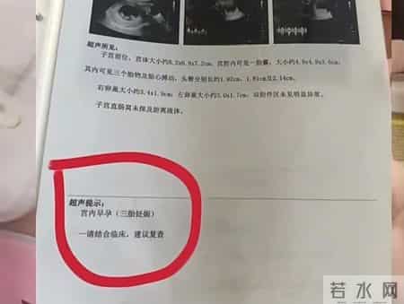 孕妇每次产检，医生都告诉她肚里又多一个孩子，你说奇怪不奇怪？
