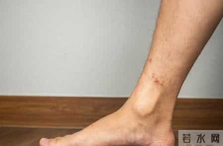 60岁大爷血压骤降昏迷，医生：苯磺酸氨氯地平不可和这3种药搭配