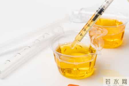 多名医生忠告：慢性肾病患者做过尿检，务必重点看这4项核心结果