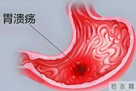 橙子再次被关注！医生发现：常吃橙子的冠心病患者 或出现4种变化