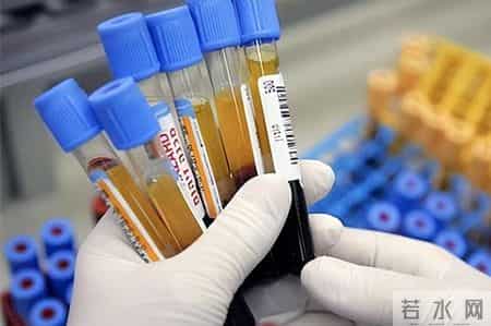 人不会无故患上冠心病？研究发现：患上冠心病，背后有5点原因