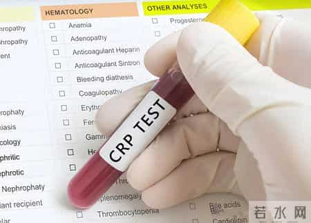 医生提醒：做好3个检查，冠心病一辈子不复发，不要走弯路