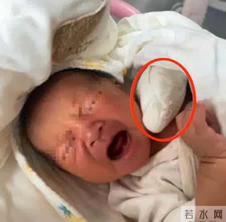 疼死了！新生儿被剪断手指紧急转院，暂不谈赔偿，家属发声太揪心