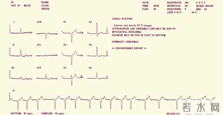 院士多次提醒：年龄过了55岁，体检主要查这6大项，别再盲目乱查
