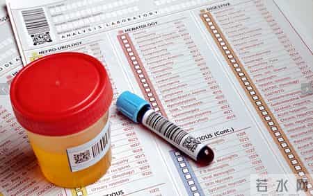 人有没有肾衰竭，看平常就知？肾病患者，日常有这6个表现！