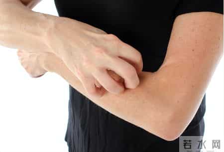 得了性病，身上这5个部位可能会长疹子，建议及时做这5个检查