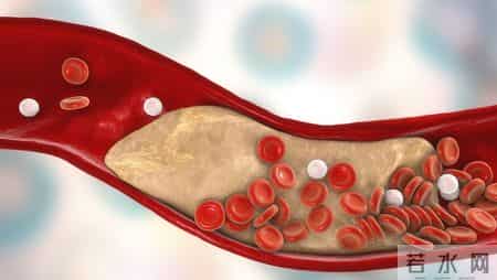 哈工大研究：低密度胆固醇越低，癌症风险越高？控制到多少才好