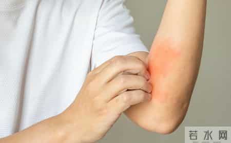 一旦感染终身携带！发作痛不欲生，超90%成人体内潜伏这种病毒