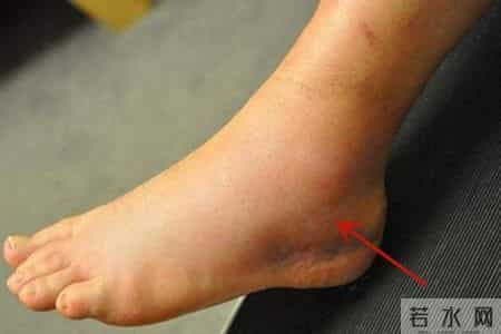 奉劝男性：5个不起眼的行为，正在“掏空”你的肾脏！别太放纵