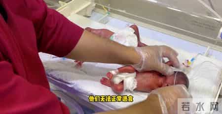 出生0.6公斤的双胞胎婴儿，50天后的样子，简直不敢认