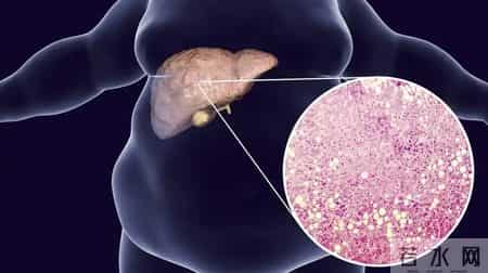 医生研究发现：每日饮酒的糖尿病人，多数临近60岁或有几种异样