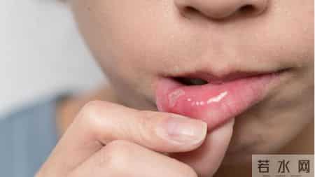 医生警告：嘴巴出现3种异常，可能是肿瘤的前兆，一定要警惕了！