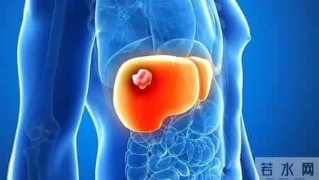 医生警告：嘴巴出现3种异常，可能是肿瘤的前兆，一定要警惕了！