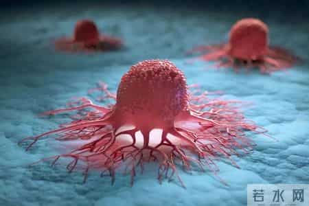 解剖癌症死者，惊讶发现患癌症的人，有4大特点
