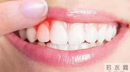 医生警告：嘴巴出现3种异常，可能是肿瘤的前兆，一定要警惕了！