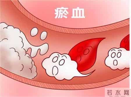 抗癌最牛的一味药，控制肿瘤20年不复发，这味药就是三棱