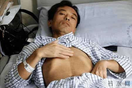 肝癌曾是亚洲“癌王”，如今防控见成效，这4招值得我们借鉴学习