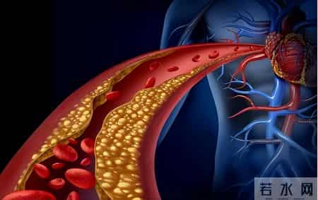 海带是血液净化剂？医生推荐：不想血液越来越粘稠，4物多吃