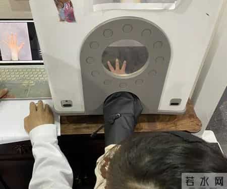 测骨龄的最佳时期只有12年，尤其是这6类孩子，家长需要高密监测