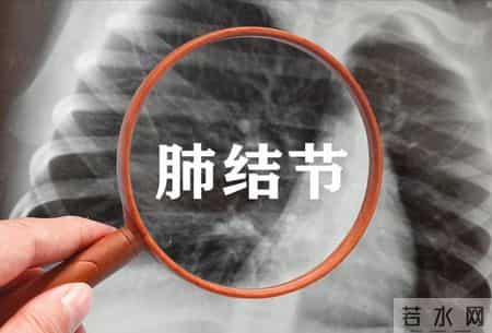 肺结节，无论做不做手术，适当喝这2种茶饮，都可能有好处！