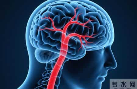 脑内科专家提醒：脑梗患者出门最好带3东西，少一样都有风险？