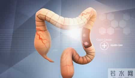 炎症是癌症的祸根，患上这3种炎症不要拖，及时干预还有救！