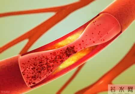 为何人最终都会死亡？医生：从血管角度来看，答案其实很简单