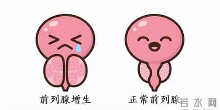 他达拉非医生为何让每天吃？他达拉非规律用药，一定要知道这3点